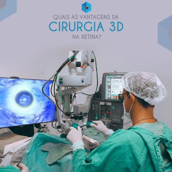 vantagens da cirurgia de retina 3d