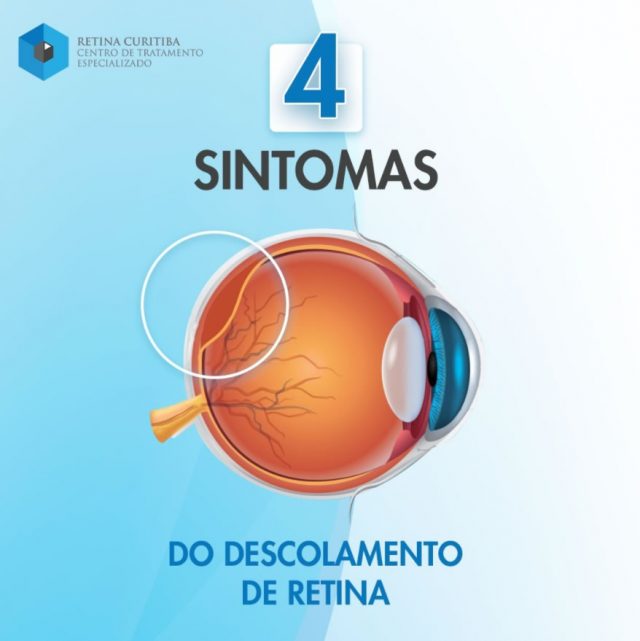 retina curitiba sintomas do descolamento de retina em curitiba