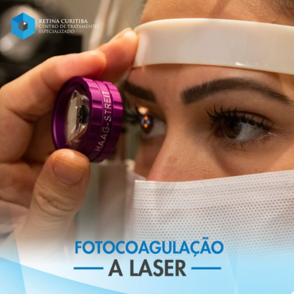 fotocoagulação a laser em curitiba