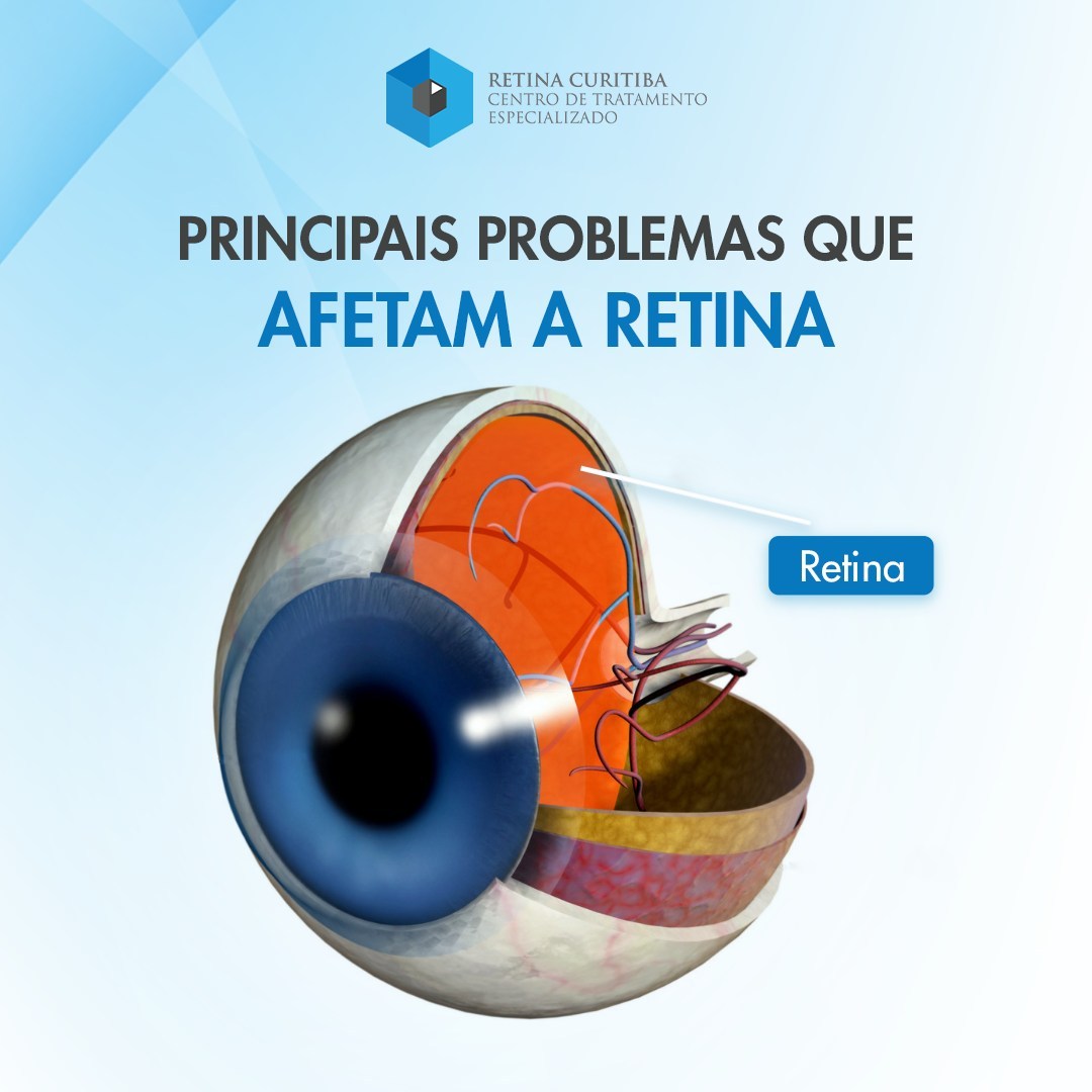 Doenças da Retina