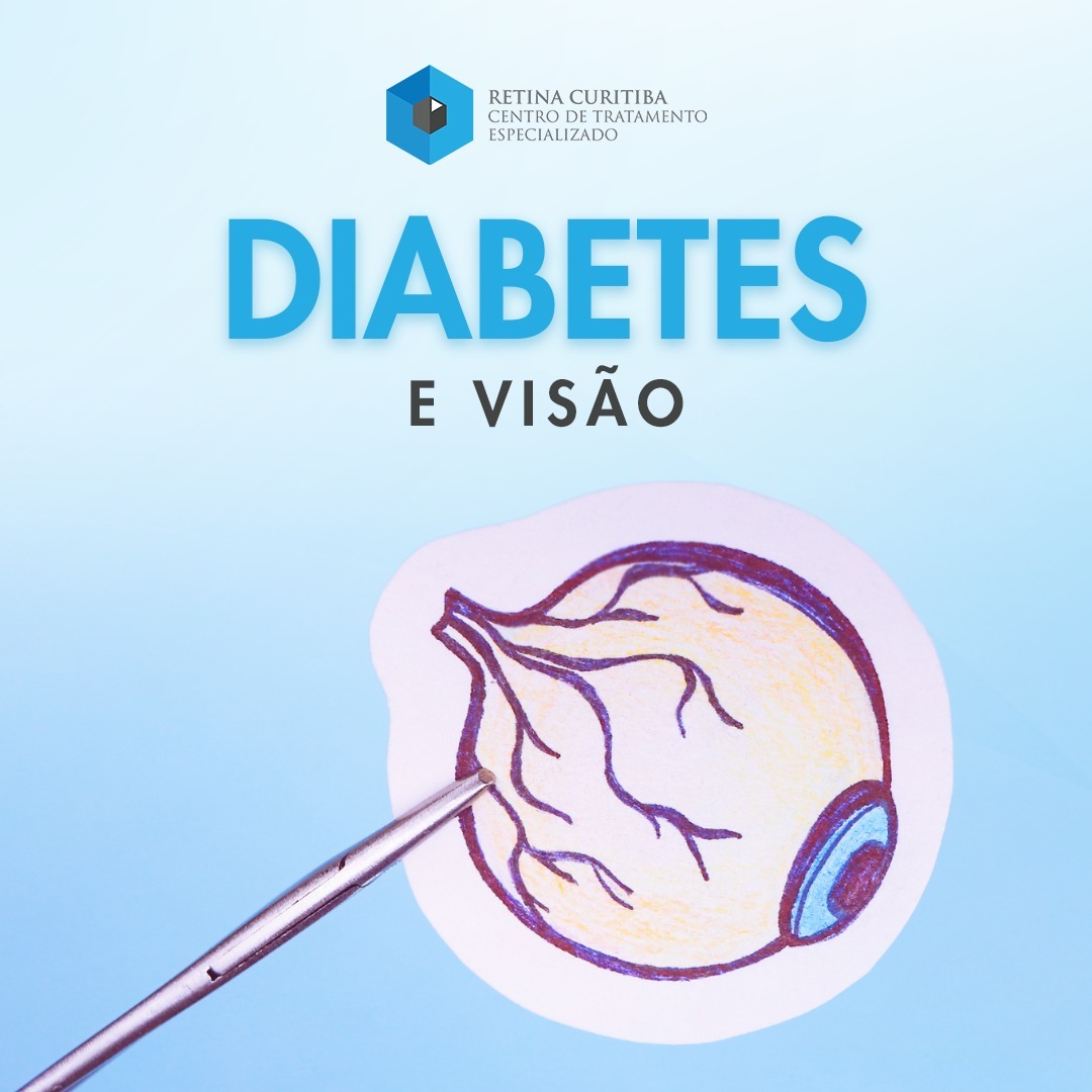 Diabetes, problemas de Visão e tratamento avançado em Curitiba