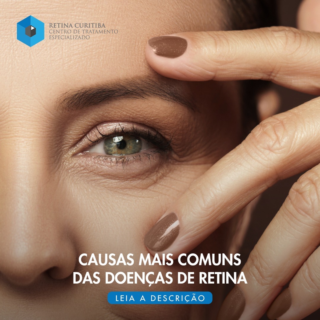 Retina Curitiba Causas mais comuns das doenças de retina