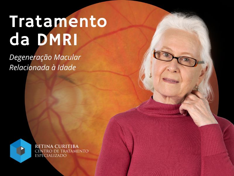 Tratamento da DMRI em Curitiba