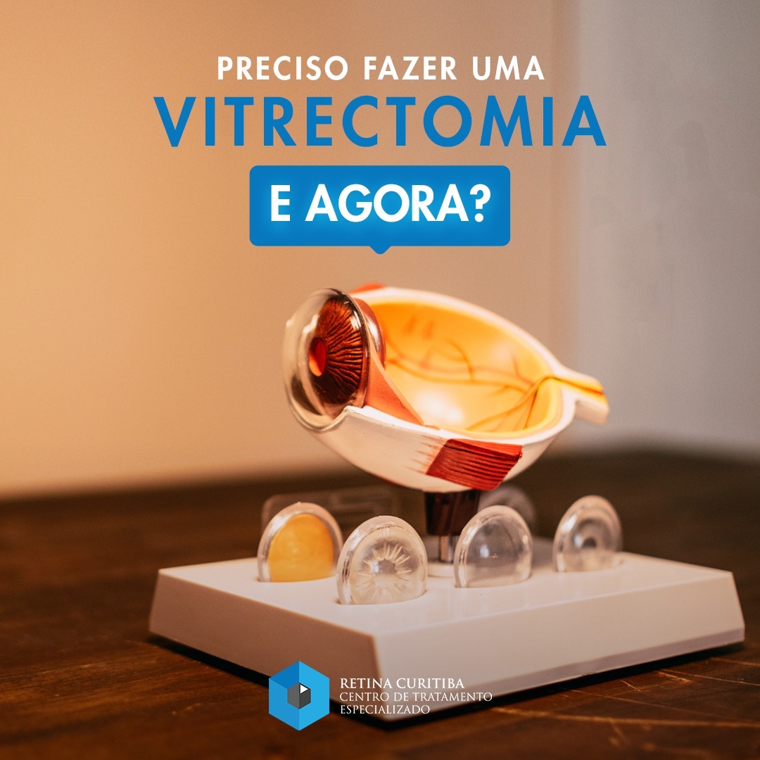 Vitrectomia em Curitiba - Preciso fazer uma Vitrectomia, e agora